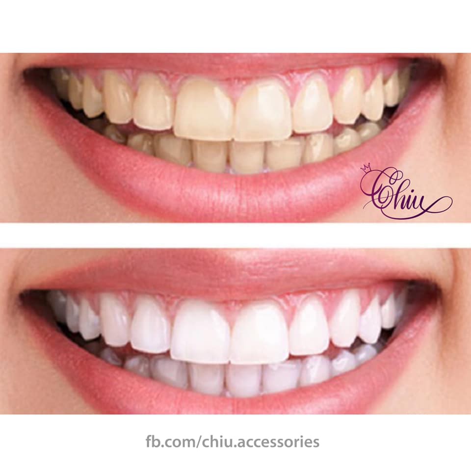 Kem đánh răng trắng răng Crest 3D White Brilliance 116g+20g