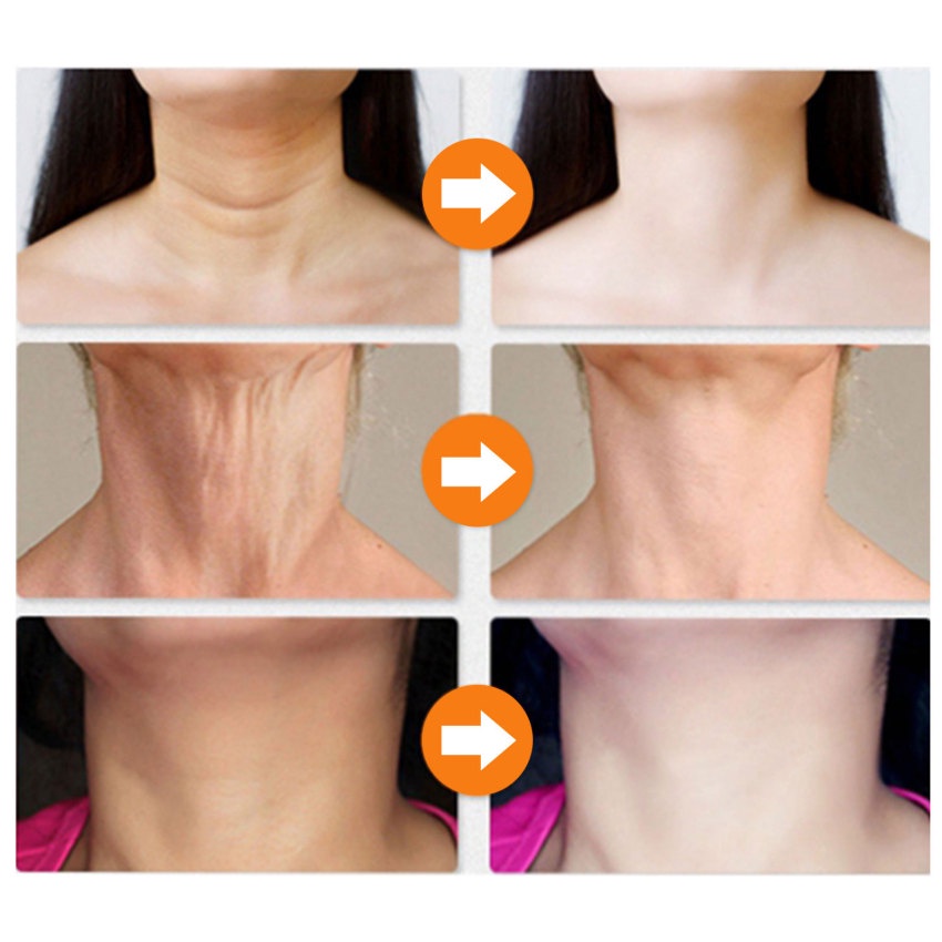 Kem Collagen Làm Trắng Da Mặt Chống Nếp Nhăn Và Làm Săn Chắc Da