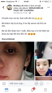 Combo 3 serum biểu bì V.Aurora