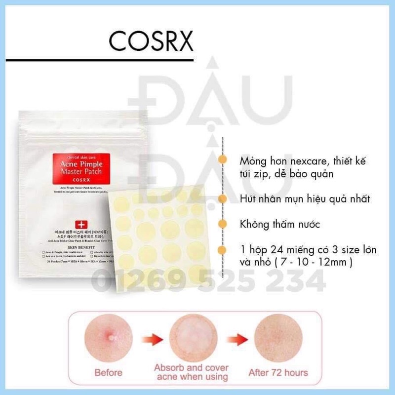 MIẾNG DÁN MỤN COSRX ACNE PIMPLE MASTER PATCH