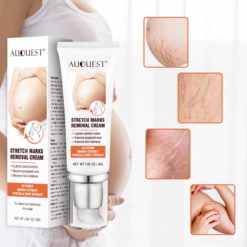 【Ready Stock】 AUQUEST Pregnant Belly Line Cream Cross-border Belly Firming Cream Reduce Postpartum Obesity Stretch Mark Repair Cream 【TB】