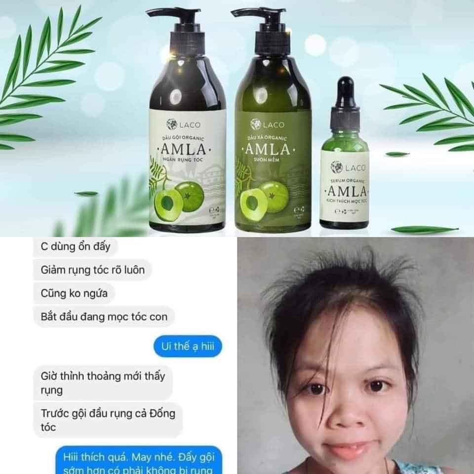 Dầu Gội Đầu 💝FREESHIP💝 Amla Laco  Ngăn Rung Tóc Sạch Gàu Hết Ngứa - Dầu Gội Organic Chiết Xuất Bồ kết Quả Amla