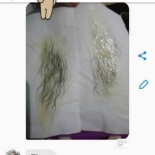 Combo triệt lông vĩnh viễn