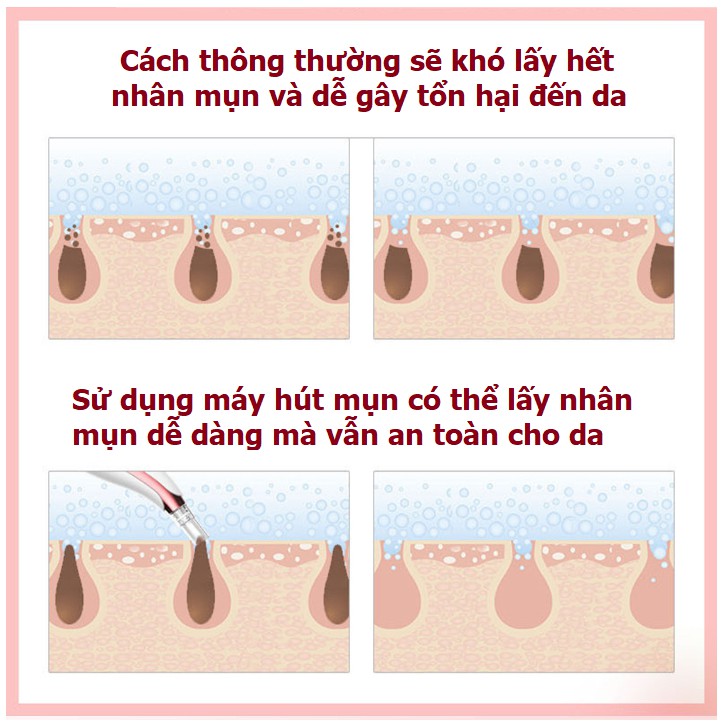 [BH 1 ĐỔI 1] Máy Hút Mụn Cao Cấp AIKEDILI MICROCRYSTALLINE BLACKHEAD INSTRUMENT | BigBuy360 - bigbuy360.vn