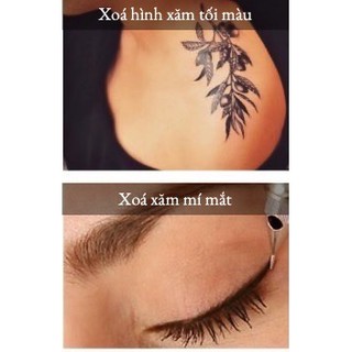 Máy xoá xăm chân mày NEATCELL- Lazer Đỏ