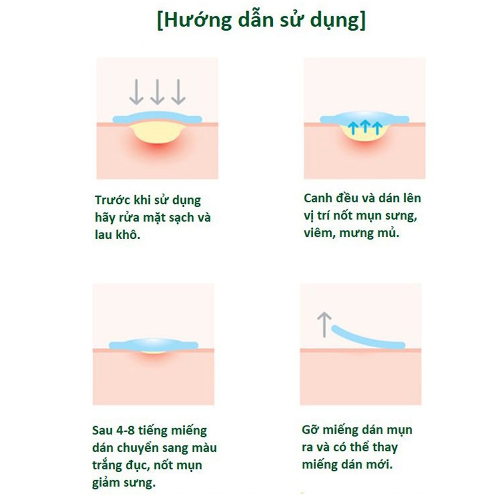 Miếng dán che mụn, mủ và hỗ trợ làm lành vết thương Somaderm L – Hàn Quốc, Hộp 1 miếng 7.5 x 7.5 cm