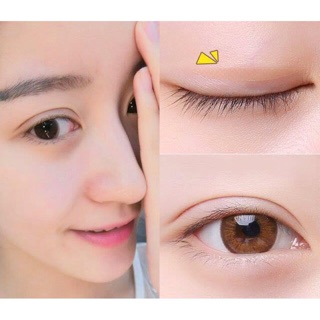Miếng dán kích mí dạng hộp