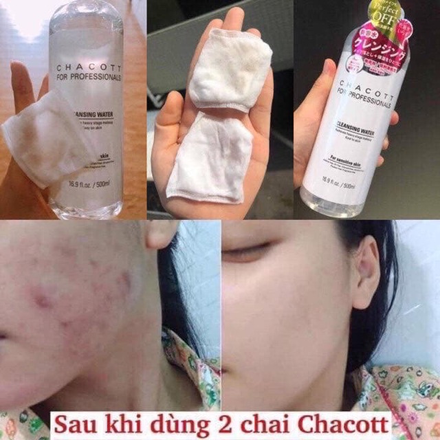 (CÓ BILL) TẨY TRANG CHACOTT NHẬT 500ML | BigBuy360 - bigbuy360.vn