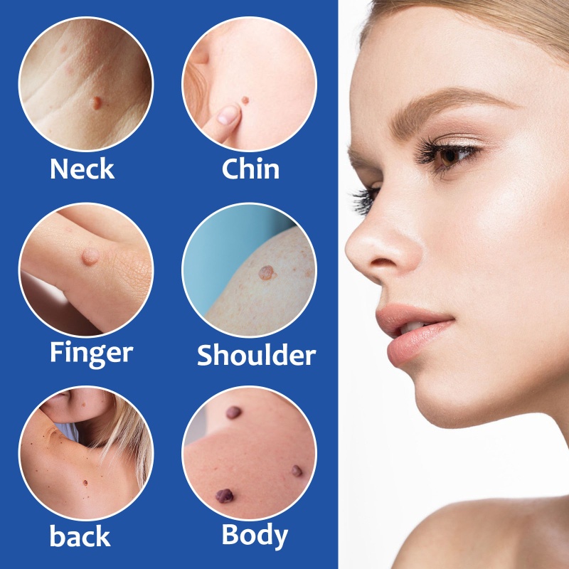 Bộ Dụng Cụ Loại Bỏ Nhãn Trên Da Cháy Nổ (1mm Đến 9mm) 2 Trong 1