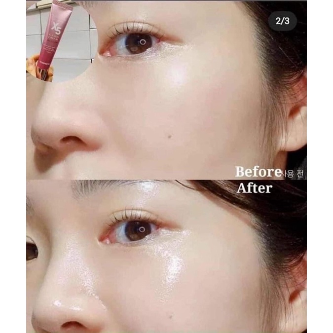 Kem Retinol X5 Elastin Thần Dược Trẻ Hóa Da Mờ Thâm Xóa Nhăn Giảm Mụn Kiềm Dầu Không Gây bong Tróc