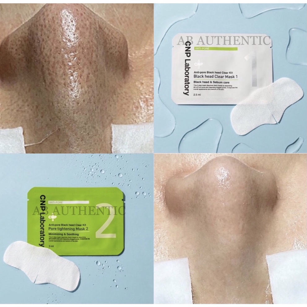 Set mặt nạ CNP Laboratory Anti-Pore Black Head Clear Kit giúp đẩy sạch mụn đầu đen và khít lỗ chân lông vùng mũi