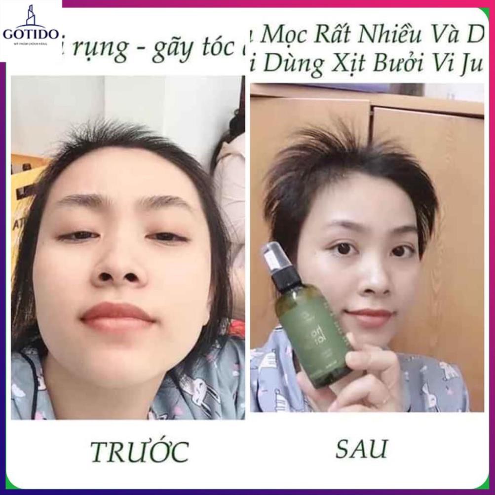 Dầu gội trị rụng tóc 280ml + Tinh dầu dưởng tóc bưởi ViJully 280ml [Ngăn rụng tóc hiệu quả] | BigBuy360 - bigbuy360.vn