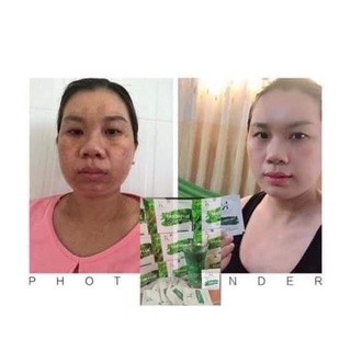 [Chính hãng]Tảo Diệp Lục collagen