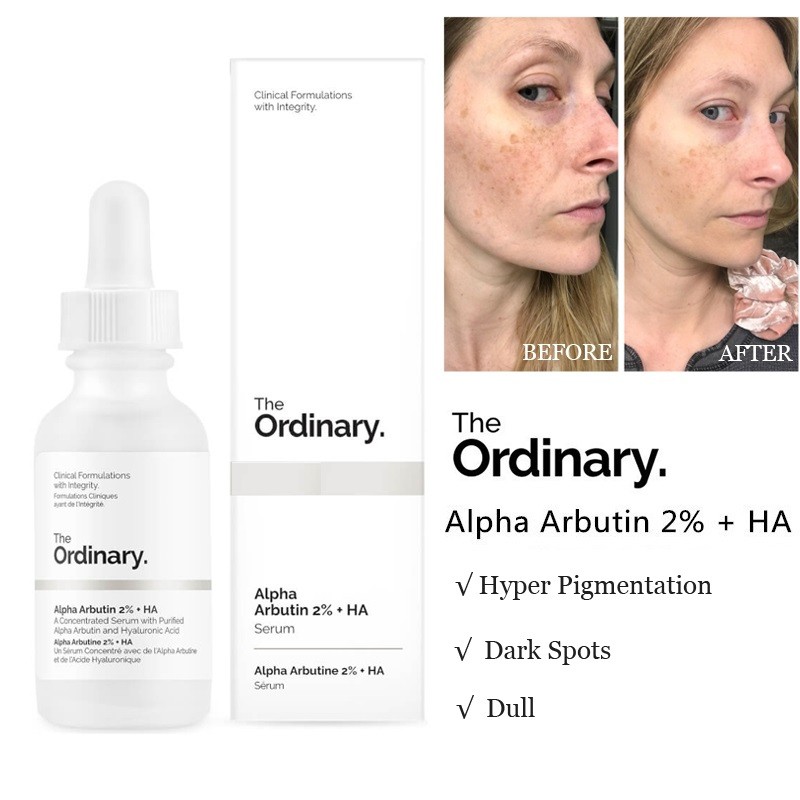 Tinh chất làm mờ nám, tàn nhang, thâm mụn The Ordinary Alpha Arbutin 2% + HA 30ml