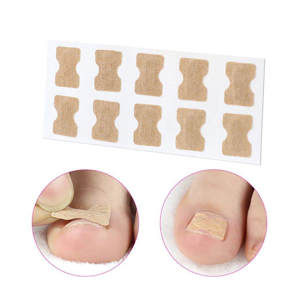 Miếng Dán Chỉnh Hình Móng Chân Chăm Sóc Sức Khỏe