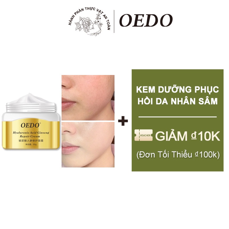 Kem Dưỡng Da Oedo Chiết Xuất Nhân Sâm Hyaluronic Acid Kiềm Dầu Làm Trắng Da Phù Hợp Cho Mọi Loại Da giúp da tươi sáng hồi Chống nhăn 50g