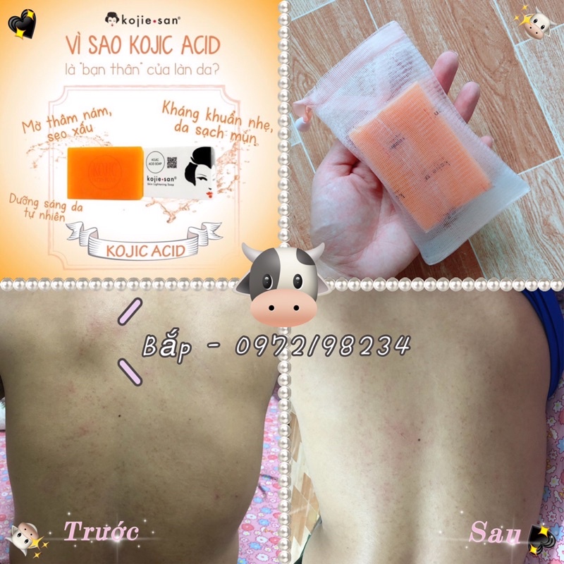 Kojiesan Skin Lightening Soap Trắng da(135g) MUA TẶNG KÈM TÚI LƯỚI TẠO BỌT