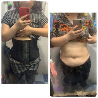 Đai nịt bụng latex
