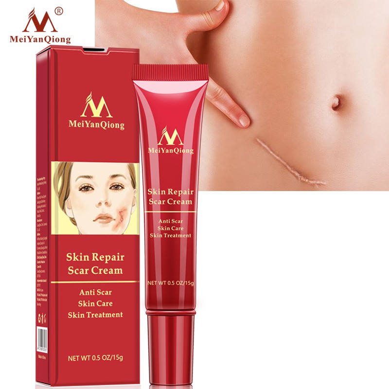 MeiYanQiong Acne Scar Removal Cream Skin Repair Stretch Marks 15ml