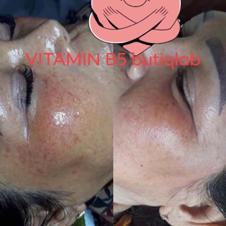 Vitamin b5 hãng butiq mẫu mới 2025