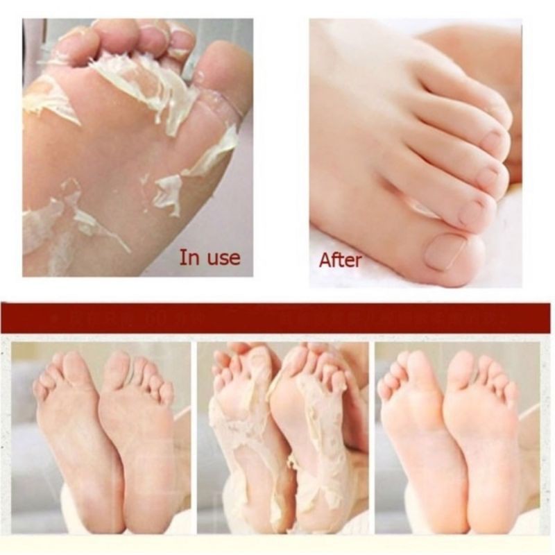 MẶT NẠ Ủ CHÂN BABY FOOT THÁI LAN