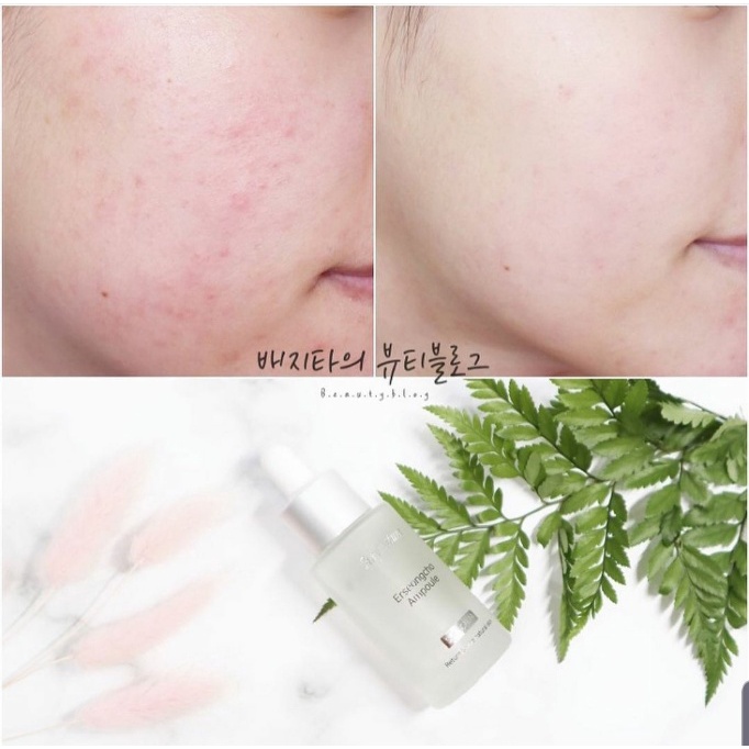 Serum diếp cá dịu da giảm mụn HEYNATURE ERSEONGCHO AMPOULE SKIN CLAM