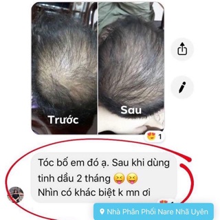 Tinh dầu bưởi Nare