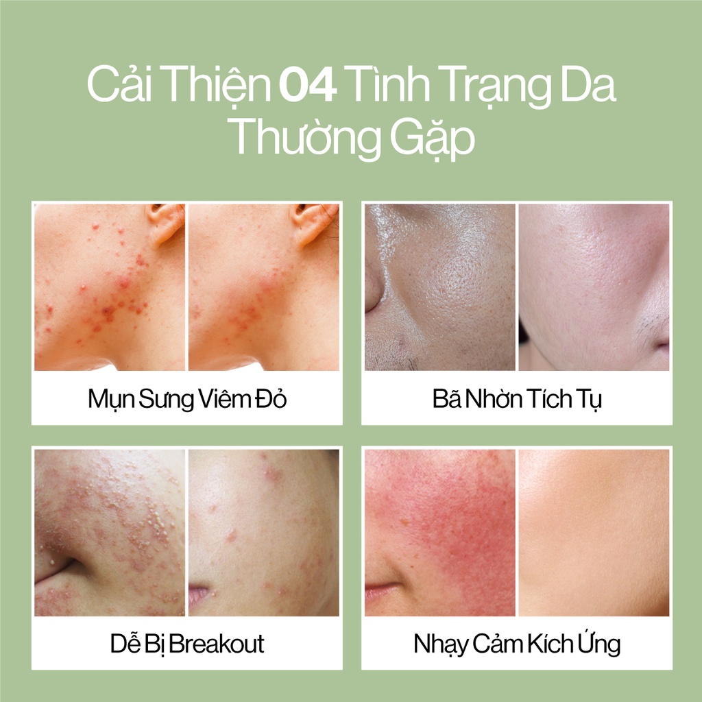 Tinh Chất Khổ Qua+ACZERO Gilaa Blemish Repair Serum giúp Giảm Mụn 30ml