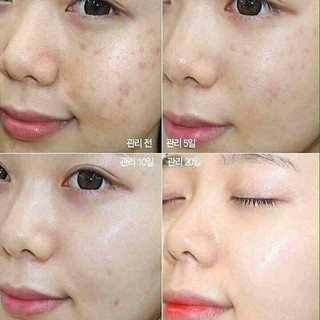 MẶT NẠ ĐẤT SÉT BẠC HÀ RAU MÁ