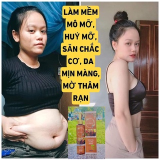 CAO GỪNG HỦY MỠ, CAO GỪNG XOA BÓP ĐÔNG Y GIẢM MỠ