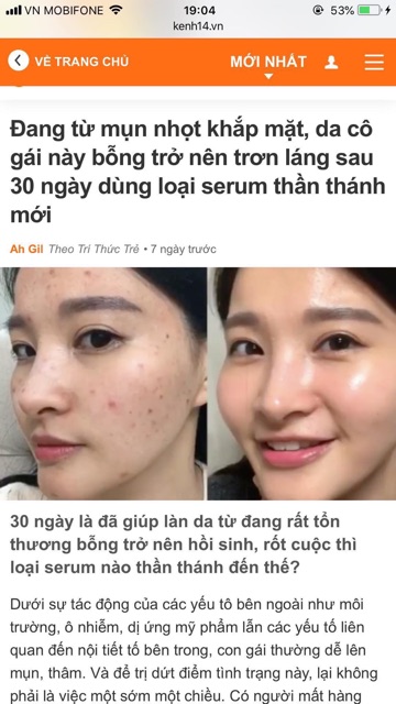 Kem dưỡng giảm mụn, phục hồi da mụn Some by mi 30days Aha - Bha - Pha