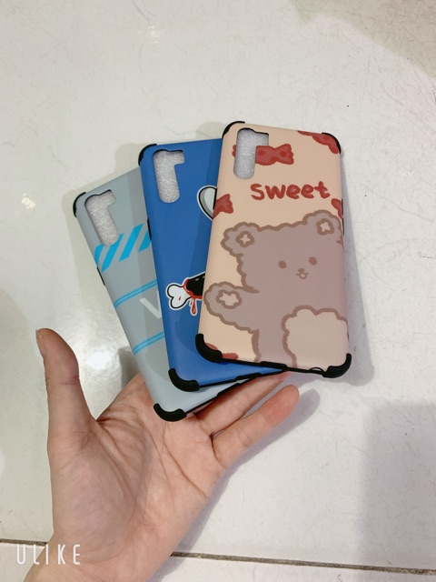 [Xả kho] Ốp Chống SỐC Sam sung A91 2020