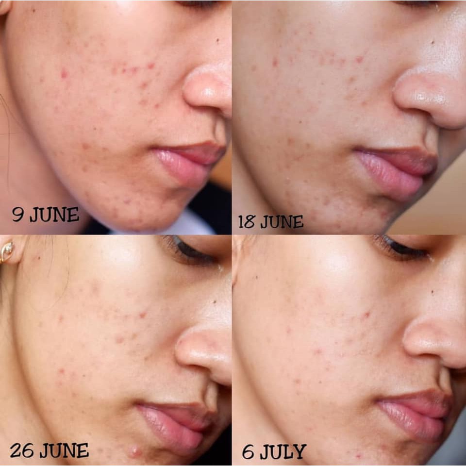 Tinh Chất Vitamin C Giúp Mờ Thâm Nám, Trắng Sáng Dành Cho Da Nhạy Cảm Klairs Freshly Juiced Vitamin Drop