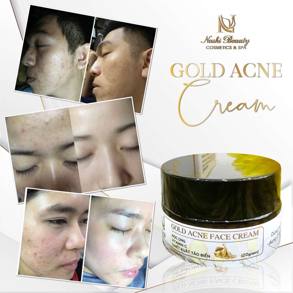 Combo Hỗ Trợ Làm Giảm Mụn Sưng Mụn Kích Ứng