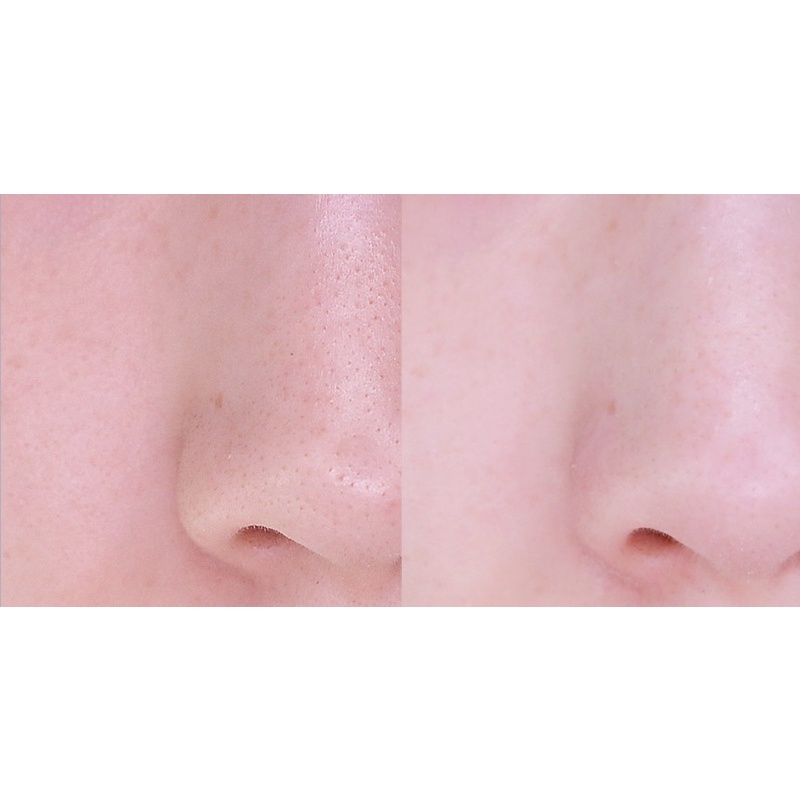 Miếng dán lột mụn đầu đen HATHERINE Pore Clear Black/ White/ Teatree Nose Strip