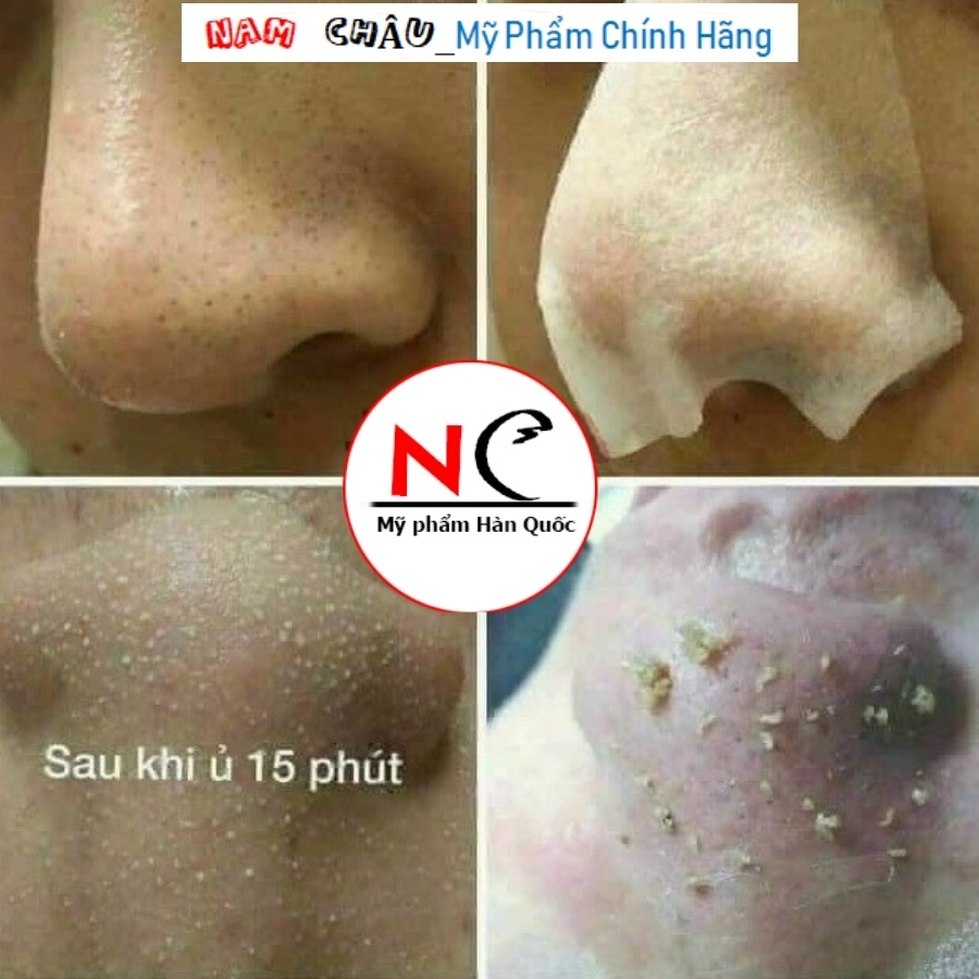 Ủ Mụn Đầu Đen Medi Peel Extra Super 9 Plus 50ml NPP Nam Châu