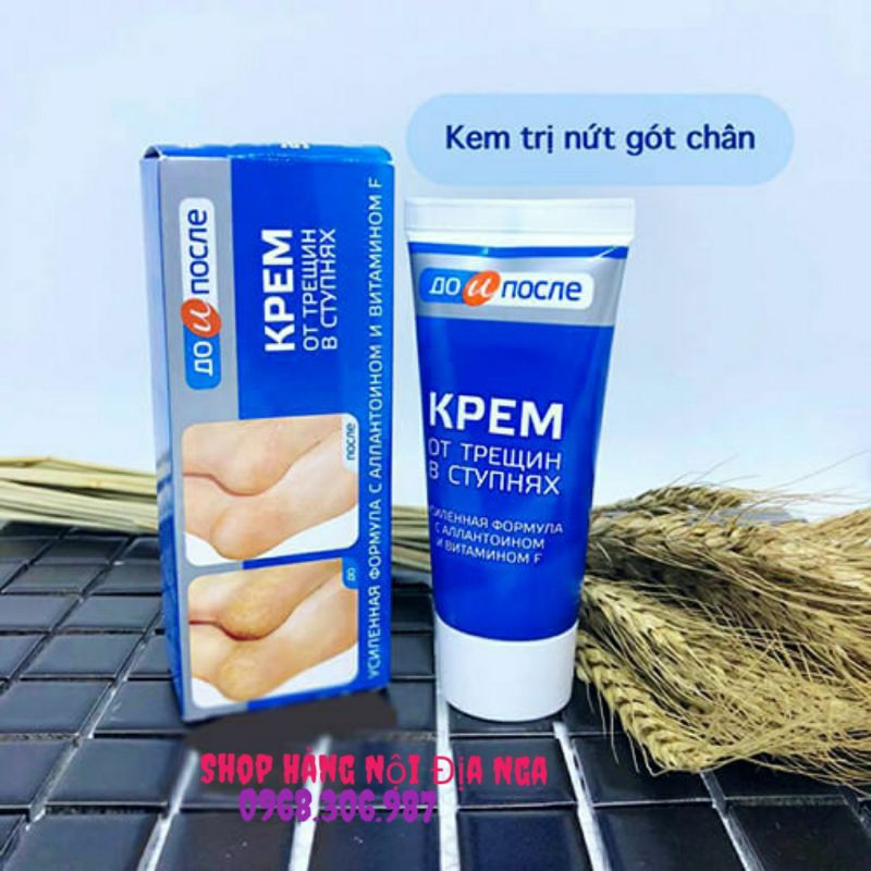 Kem trị nứt gót chân kpem Apteka chính hãng Nga