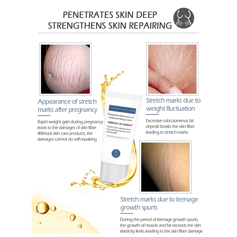 Kem Hỗ Trợ Giảm Sẹo Sau Khi Sinh VIBRANT GLAMOUR Làm Trắng Và Săn Chắc Mịn Mượt Chống Lão Hóa 30g