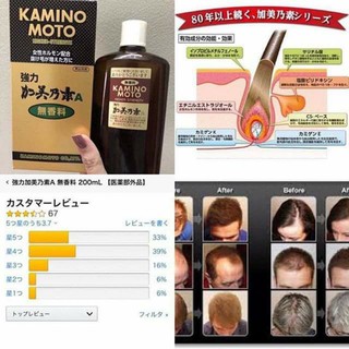 Mọc tóc kaminomoto Nhật Bản