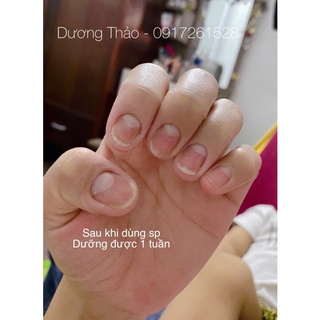 Dưỡng móng. dài móng - cứng móng