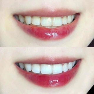 (Mẫu mới) Kem đánh răng Crest 3D White Advanced  Whitening 147g