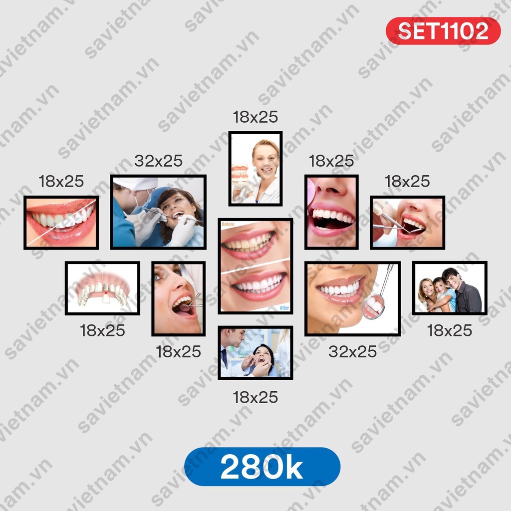 Set tranh fomex trang trí nha khoa
