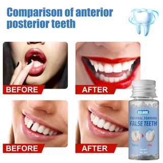 30g Resin Vampire Teeth Glue Temporary Tooth Replacement Material Tooth Filling Missing Denture Adhesive DIY Teeth Repair Dental
 techer