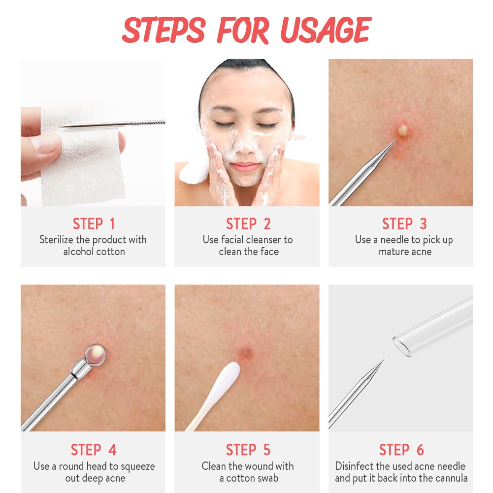1 Kim Nặn Mụn Đầu Đen / Mụn Trứng Cá Hai Đầu Chăm Sóc Da GECOMO