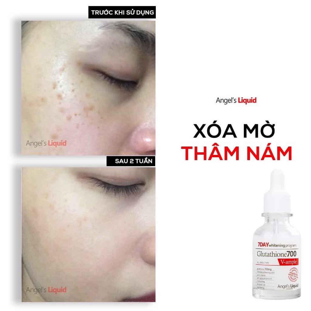 Serum Dưỡng Trắng Và Cấp Ẩm Angel's Liquid 7day Whitening Program Glutathione 700 V-Ample 30ml