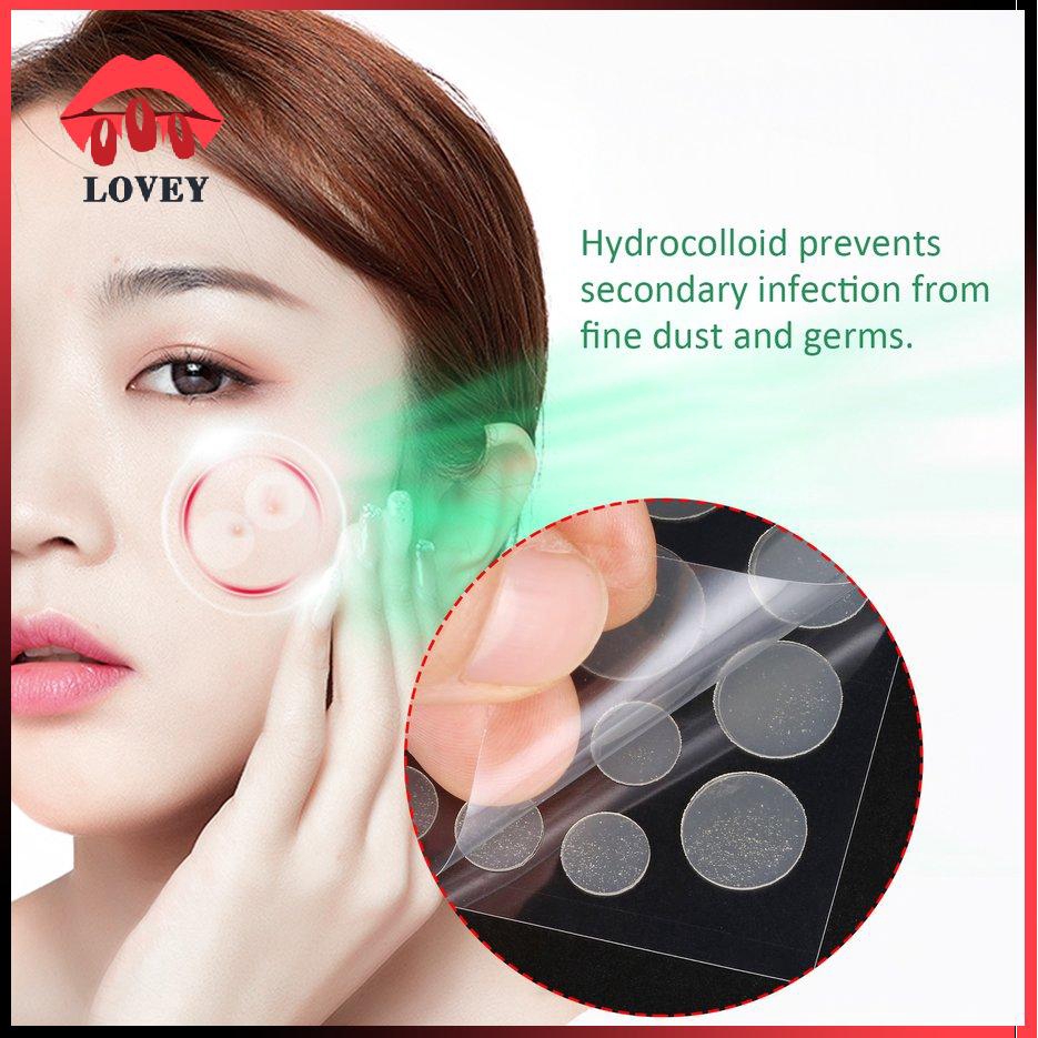 Miếng dán loại bỏ mụn chăm sóc làn da hiệu quả tiện lợi