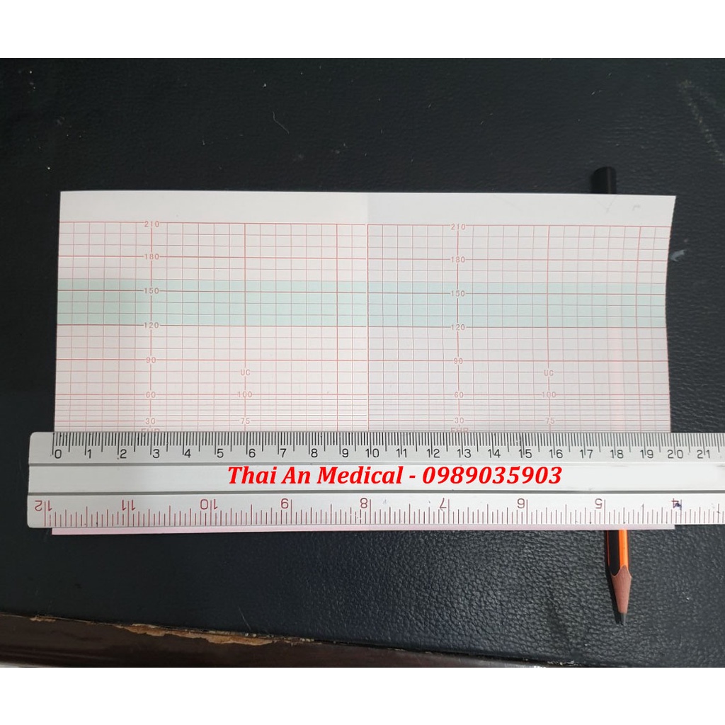 Giấy monitor sản khoa Goldway UT-3000A Edan MFM-800 sọc đỏ 112x100x150