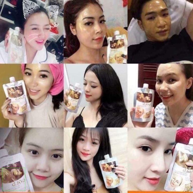 Combo sỉ 10 gói cấy trắng mầm gạo non, vàng nano, huyết hoa hồng, tảo sủi bọt, nghệ sủi bọt 150ml