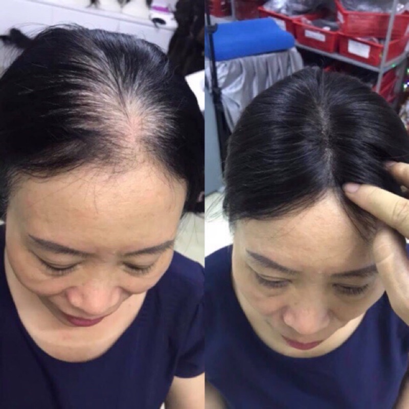 Tóc che hói che bạc ❇️hàng đẹp ❇️MIỄN PHÍ SHIP ĐƠN 50k ❇️