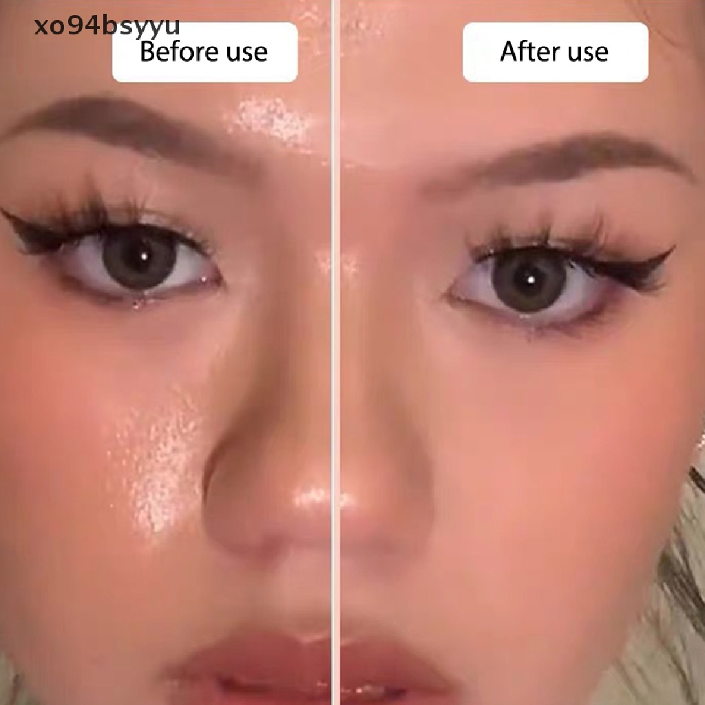 Cây Lăn Đá Núi Lửa Xo94Bsyu Kiểm Soát Dầu Chăm Sóc Da Mặt